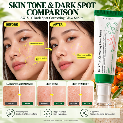 AXIS-Y Dark Spot Correcting Glow Serum – Niacinamide 5% Brightening Serum, 50ml